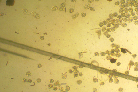 Digital photograph of coiled trichinella larvae (middle right above) microscope at 40x magnification